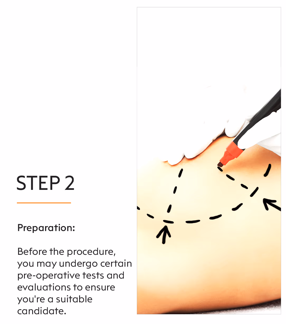 Lipo Injection 4
