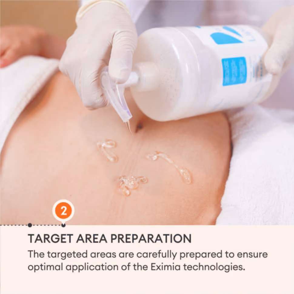 Eximia Body 4