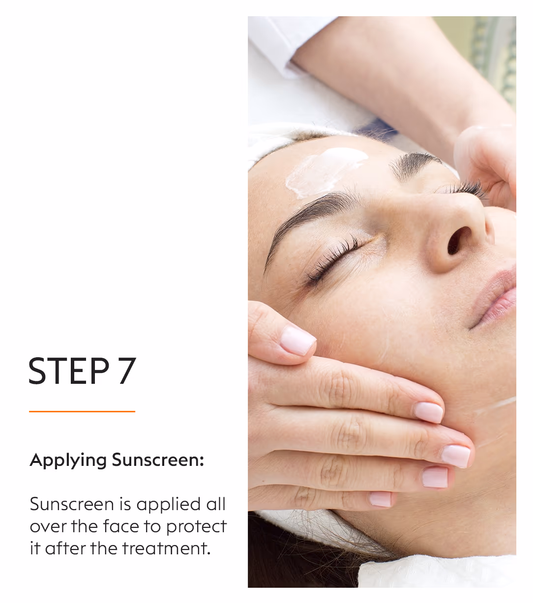 Chemical Peels Acne Scars Treatment 12
