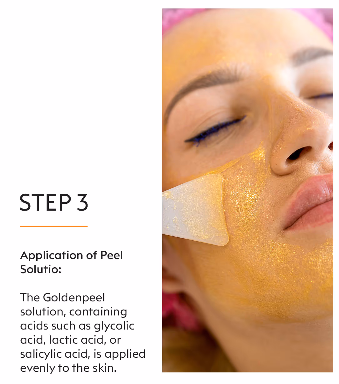 Golden Peel 5