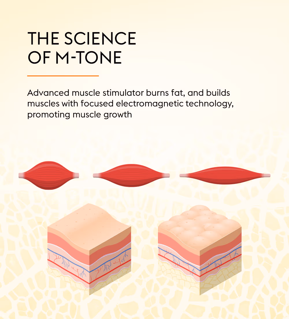 M-Tone Skin & Muscle Toning Treatment 2