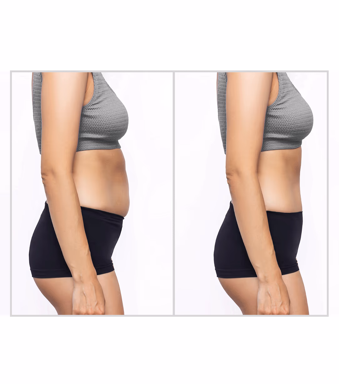 Termoslim Fat Loss Treatment 1