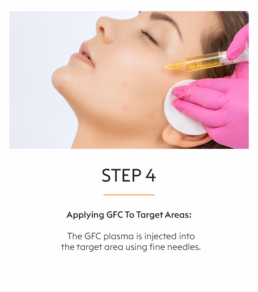 GFC Skin Whitening Treatment 6