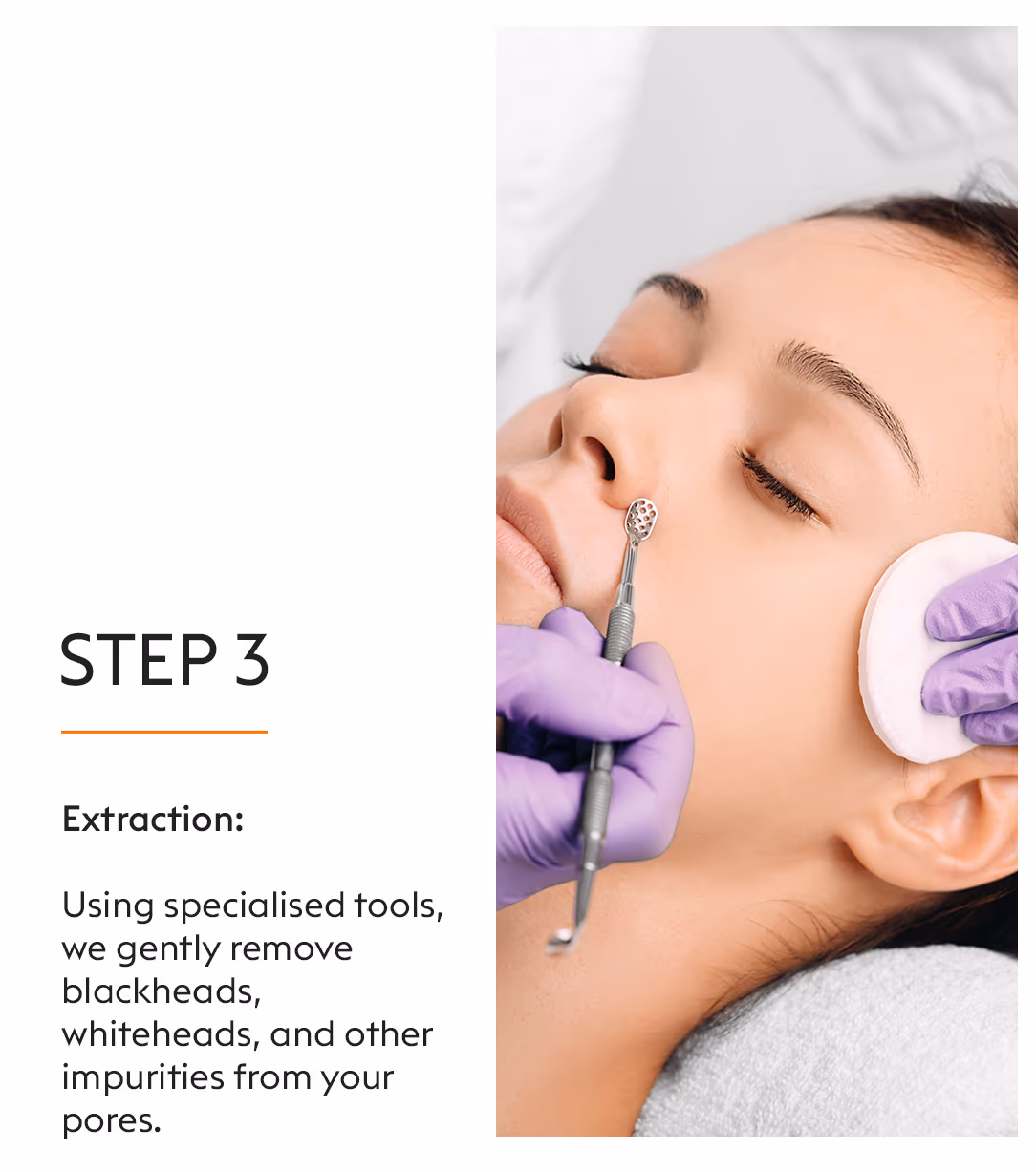 Blackheads Clogged Pores Removal Treatment 5