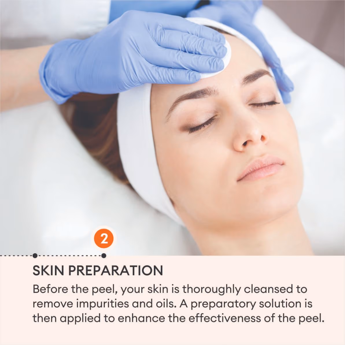 Chemical Peels 4