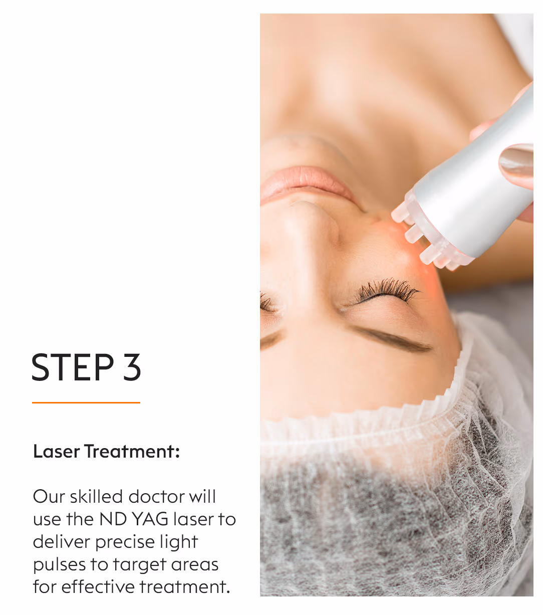 Nd Yag Laser Pigmentation Treatment 5