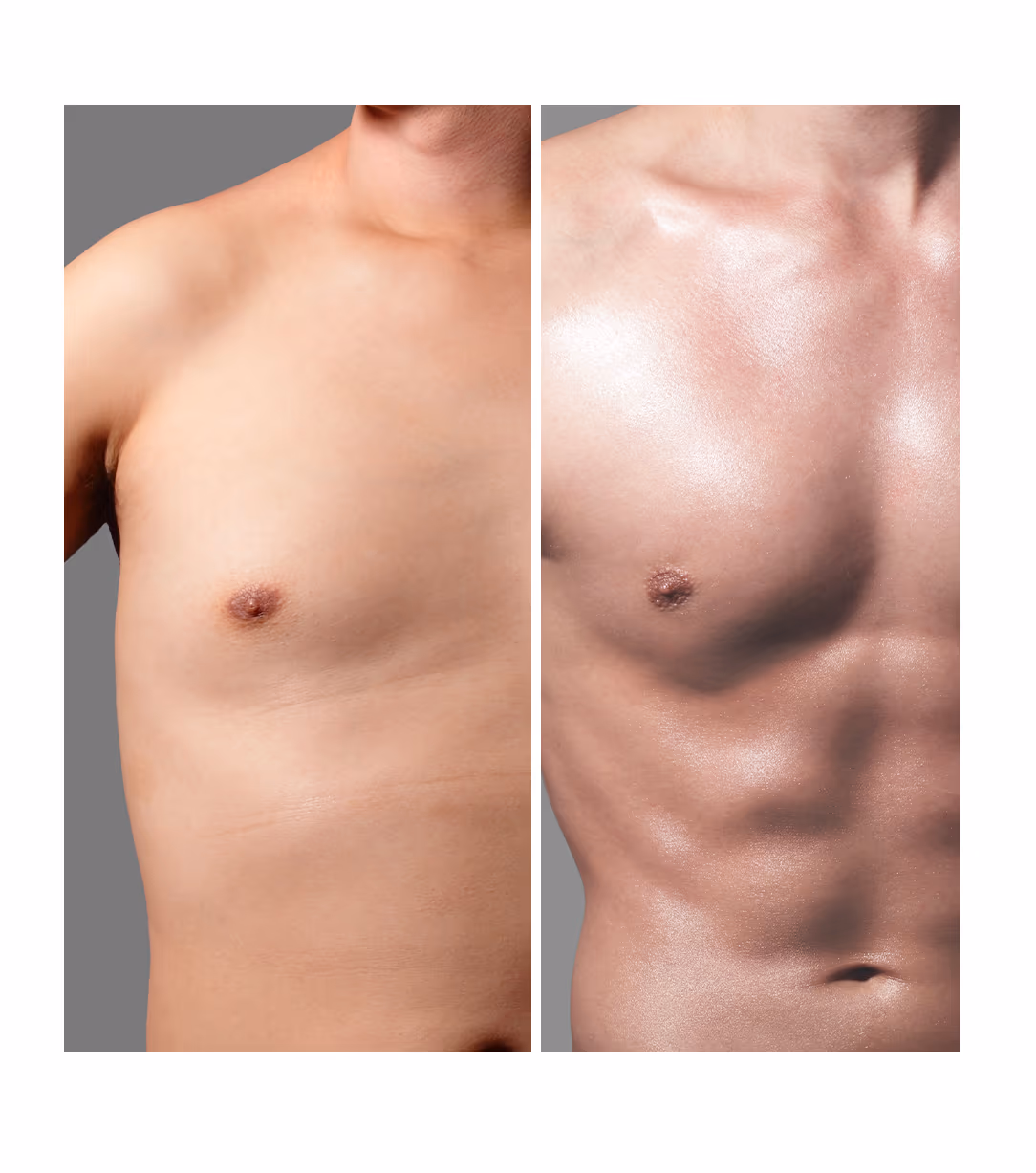 Lipo Injection 1