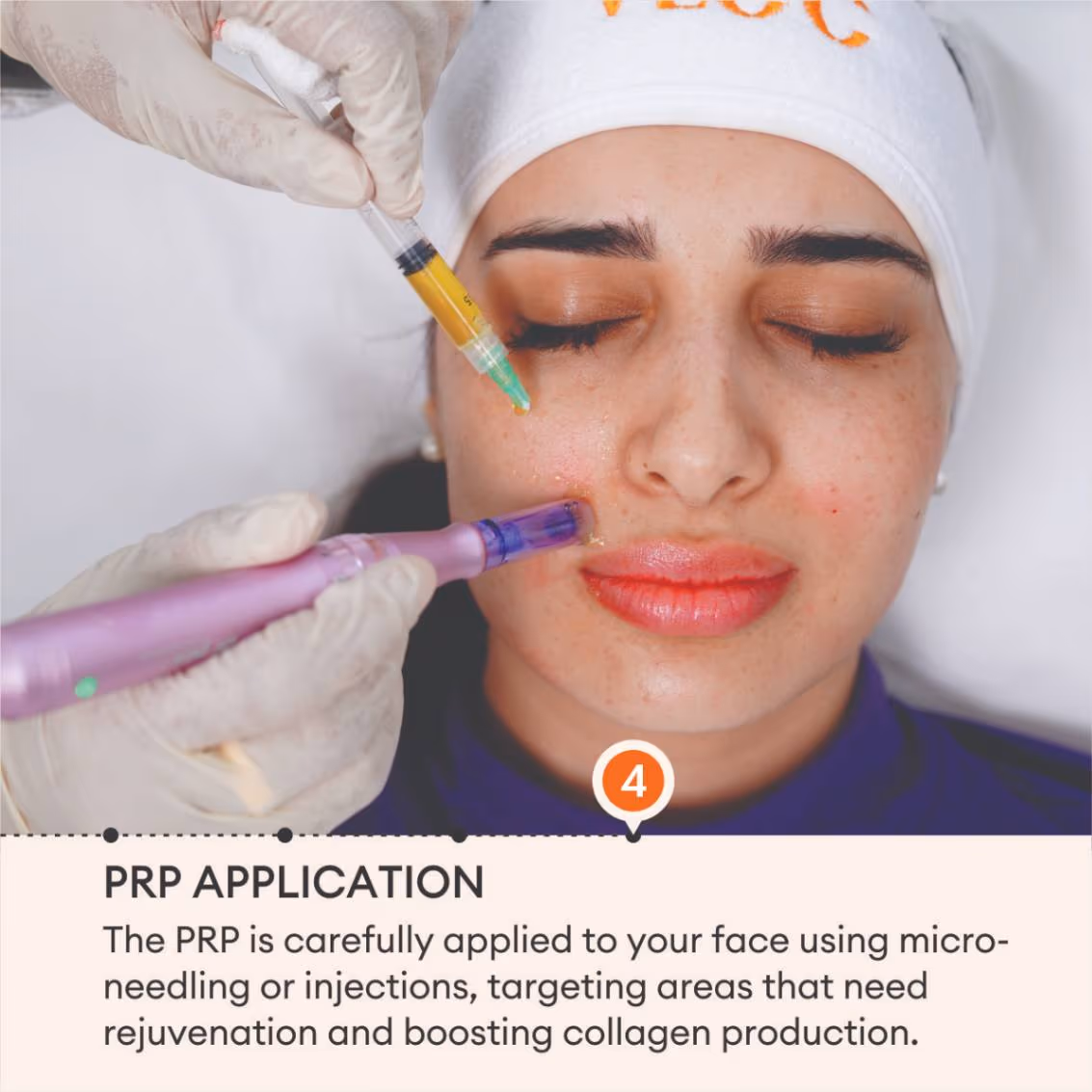 Face PRP 6