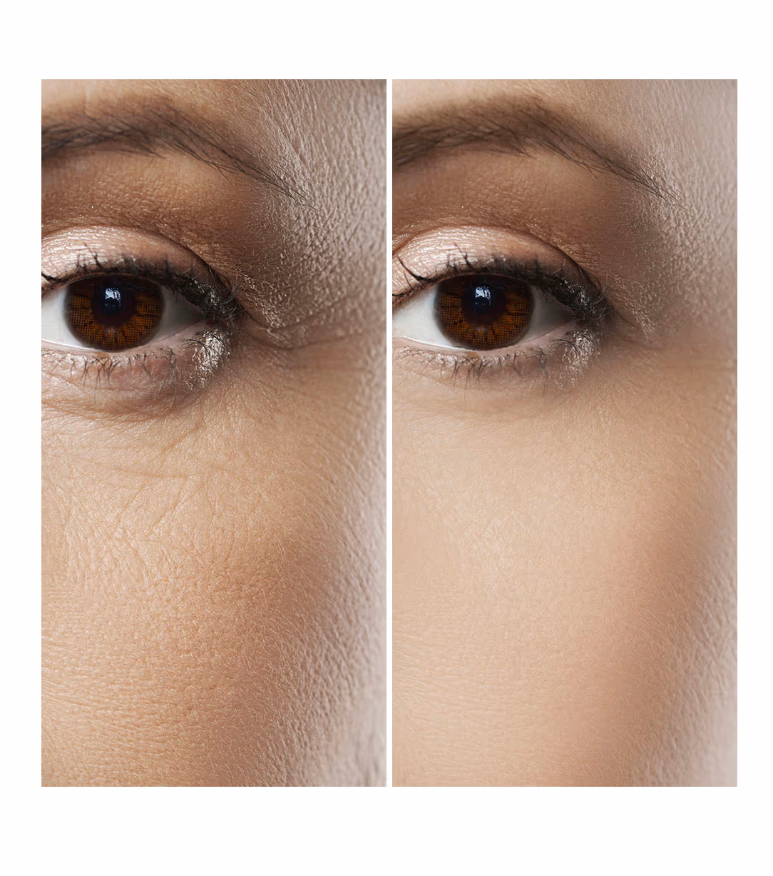 OxyGeneo Facial 1