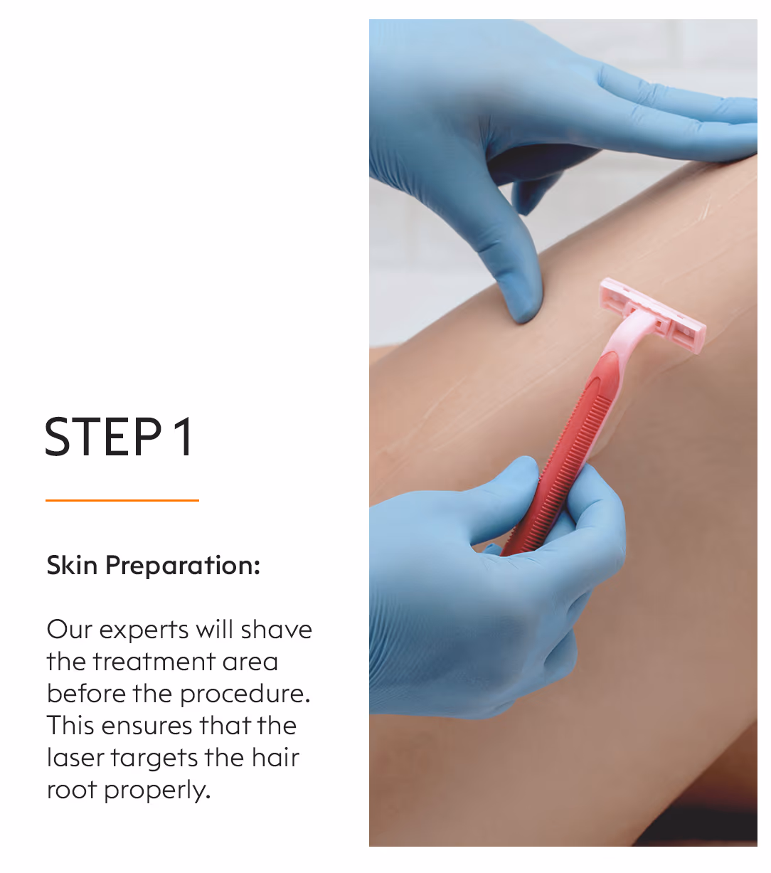 Full Body Laser Hair Removal Treatment 3