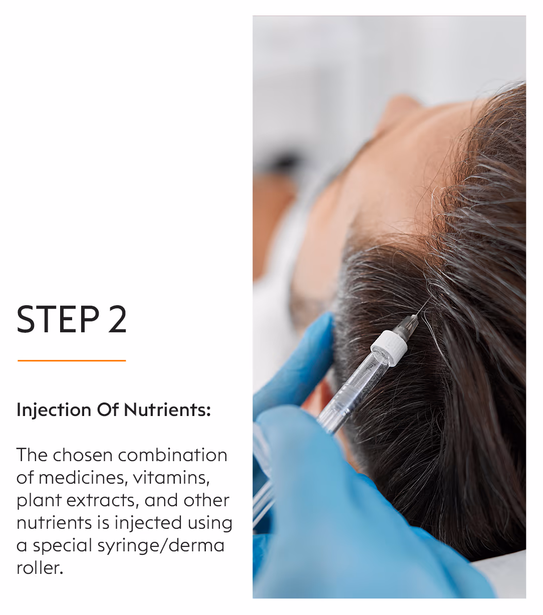 Mesotherapy 4