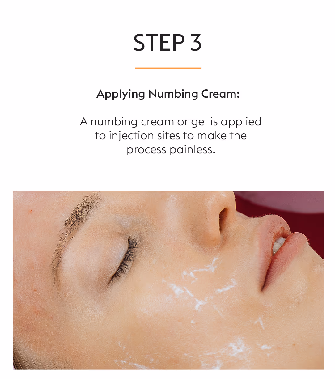 Face Fillers Injection Treatment 5