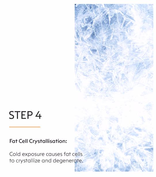 Coolsculpting Fat Loss Treatment 8