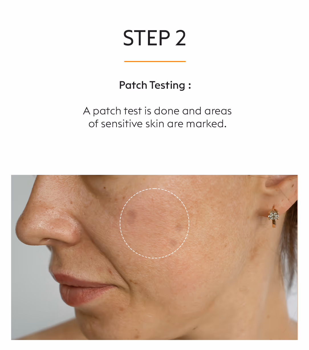Tubelite Micro Peel Skin Whitening Treatment 4