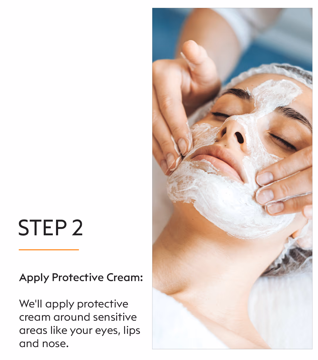 TCA Chemical Peels Skin Whitening Treatment 4