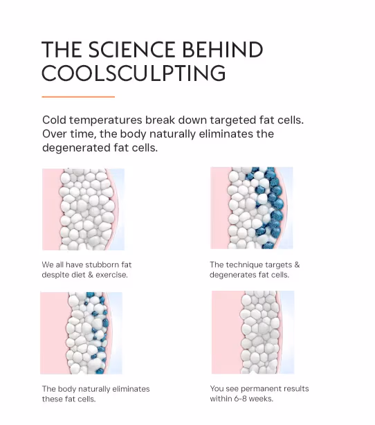 Coolsculpting Fat Loss Treatment 3
