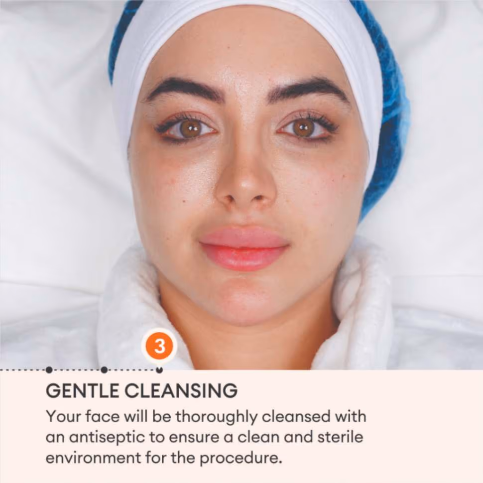 Dermal Fillers 5