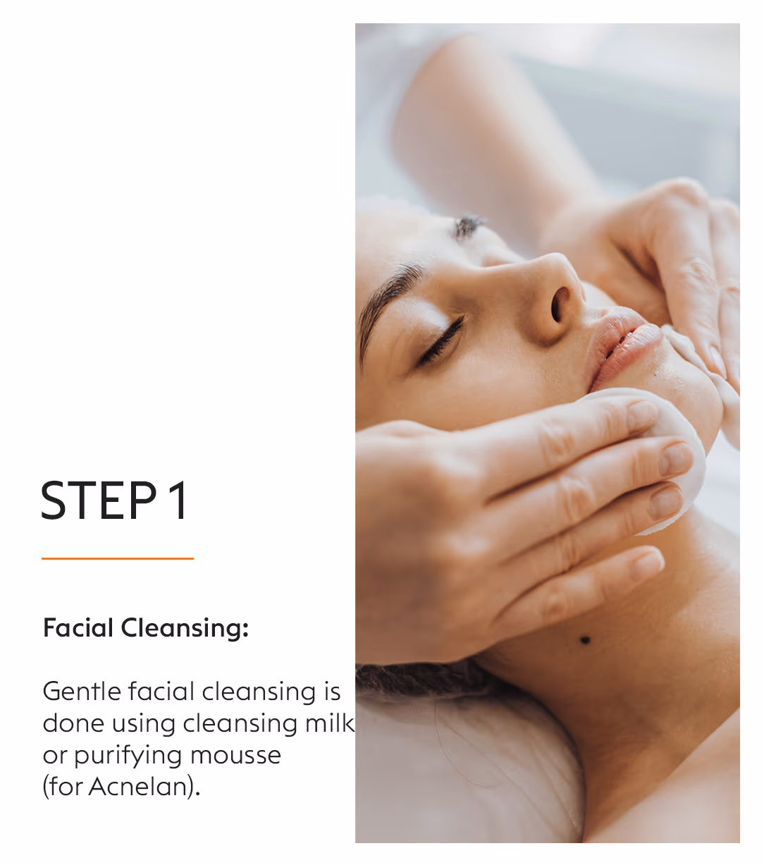 Chemical Peels Acne Scars Treatment 6