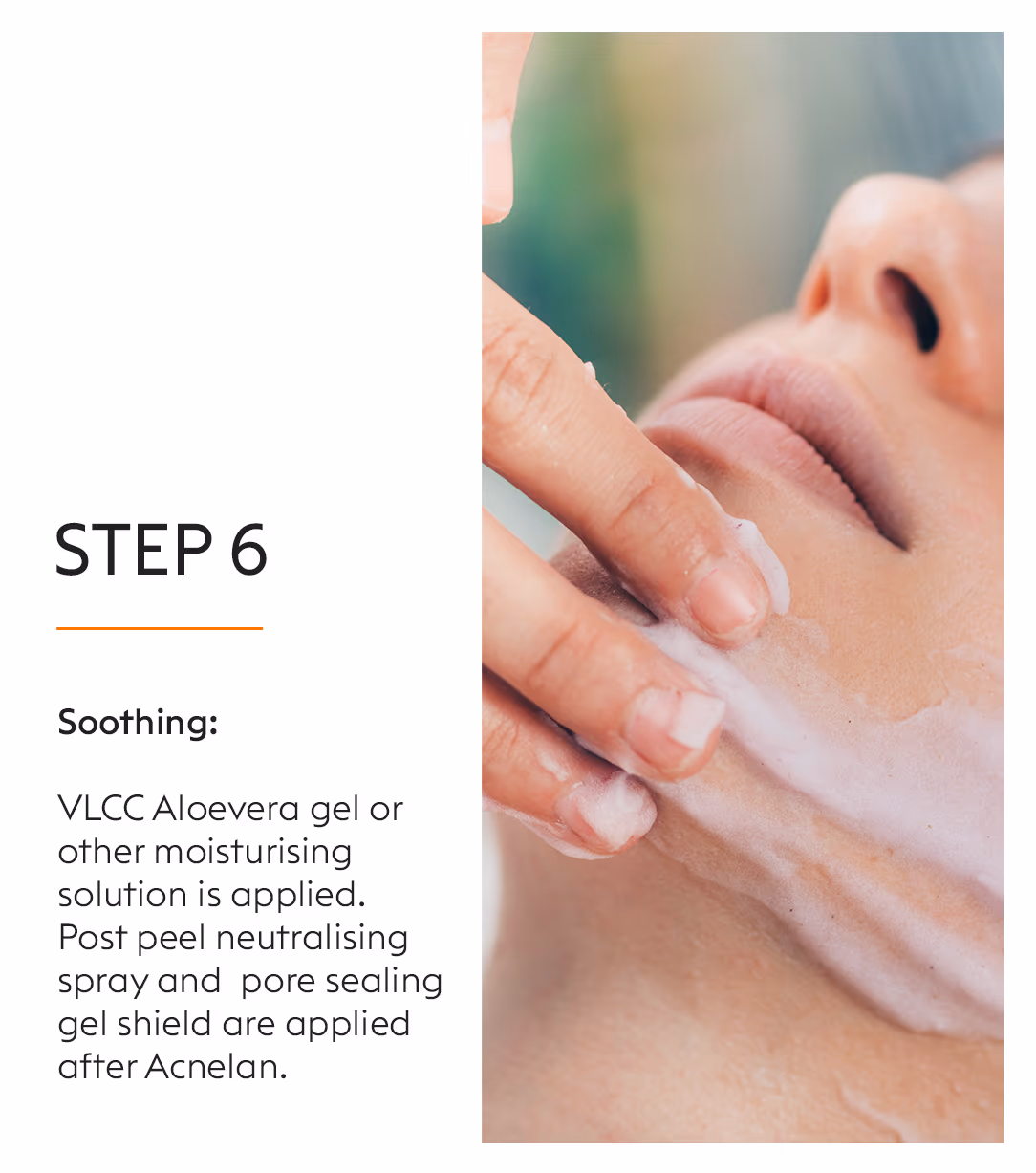 Chemical Peels Acne Scars Treatment 11