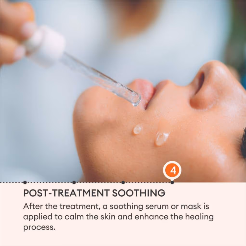 Microneedling 6