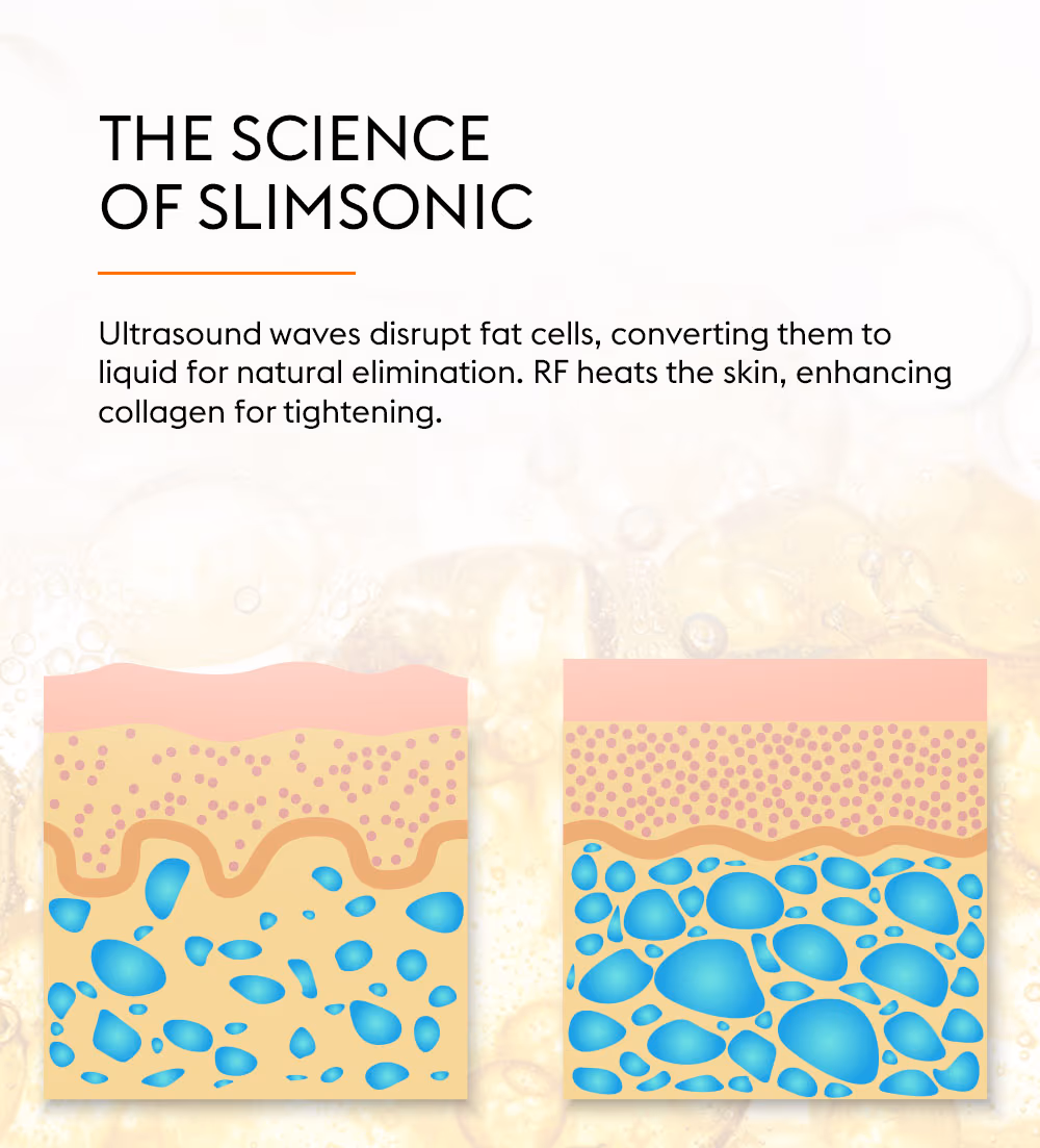 Slimsonic 2