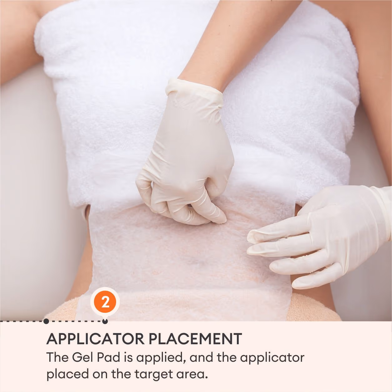 Cryolipolysis (Coolsculpting) Fat Removal 5