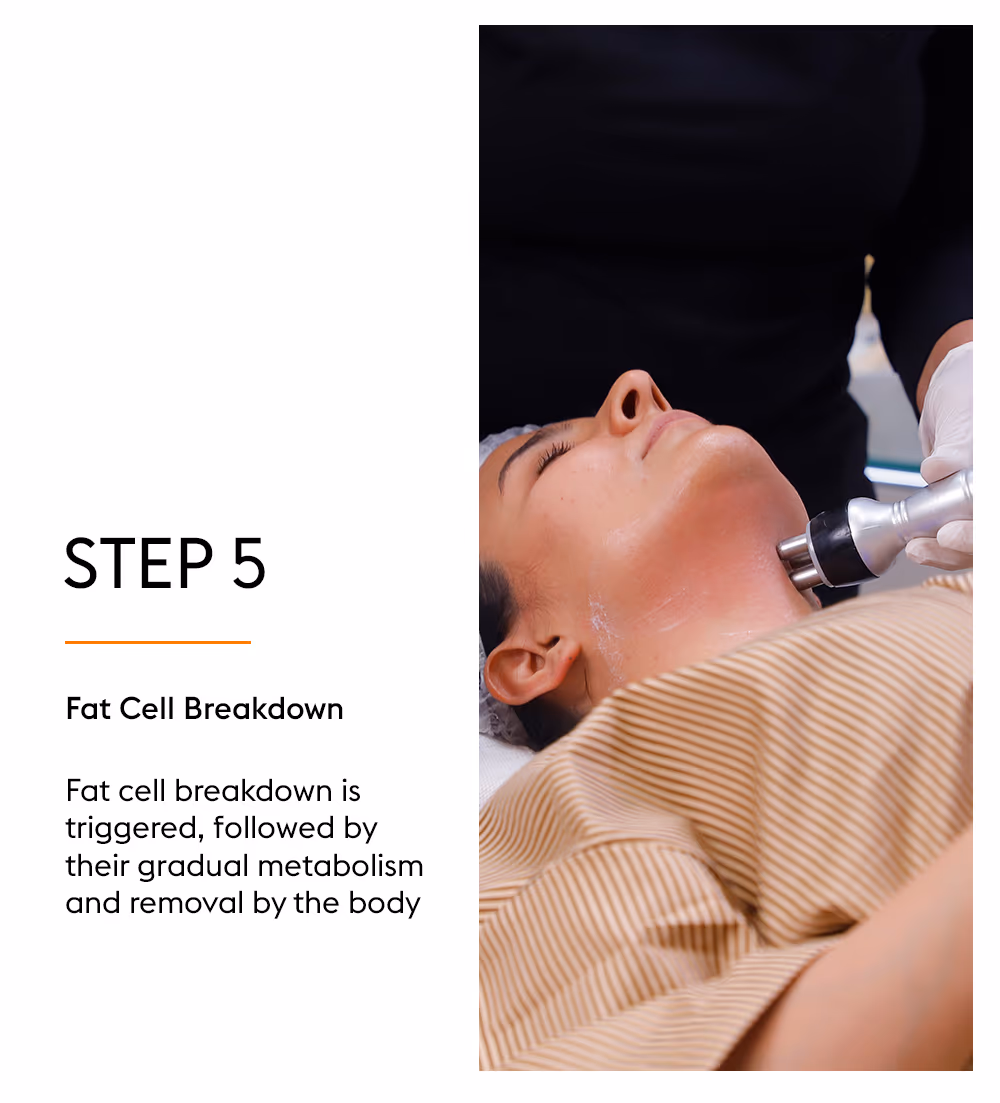 Lypolysis 7