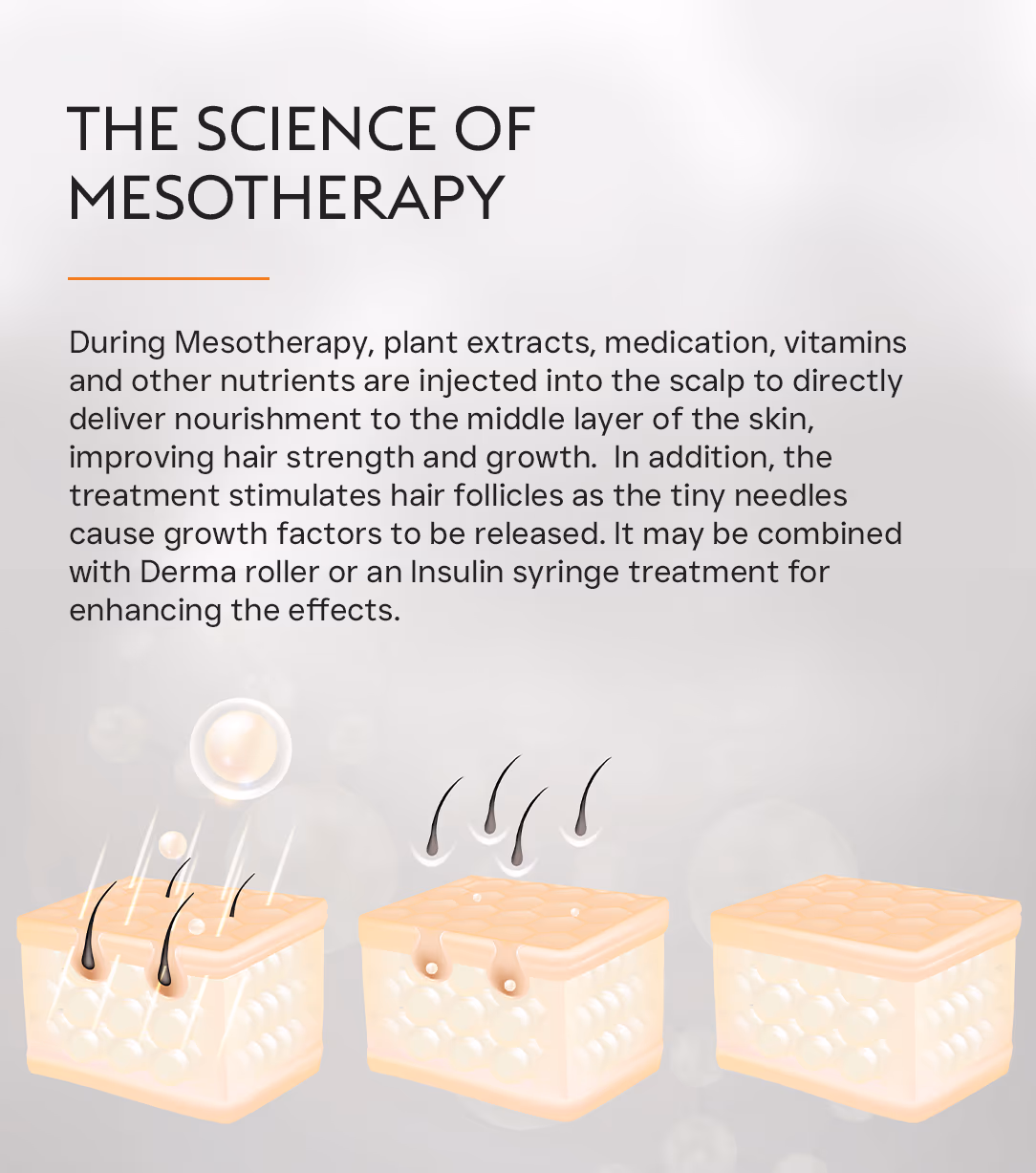 Mesotherapy 2
