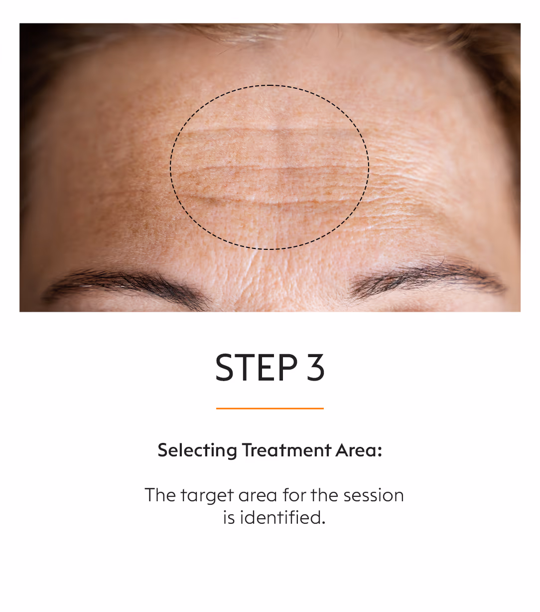 GFC Hair Fall Treatment 5