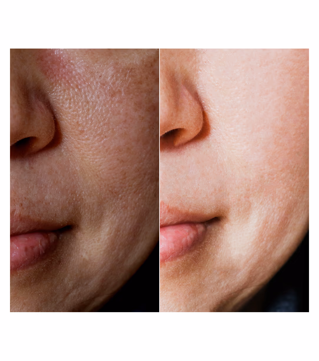Cosmedermat Facials 1