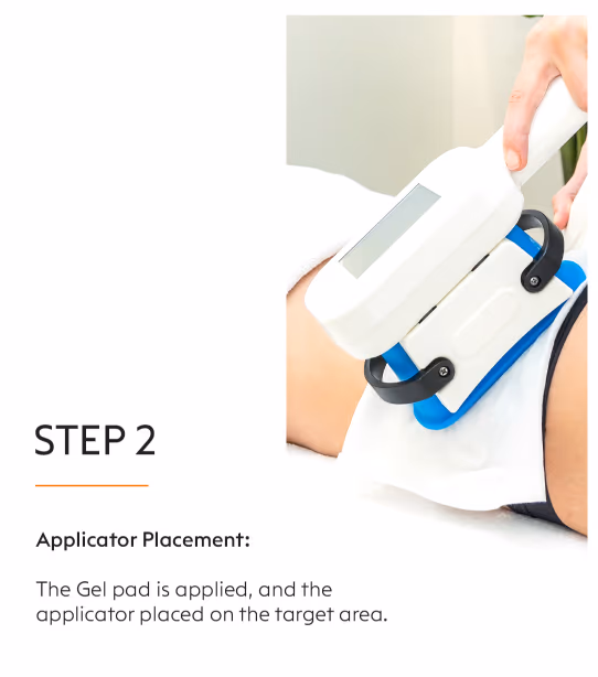 Coolsculpting Fat Loss Treatment 6
