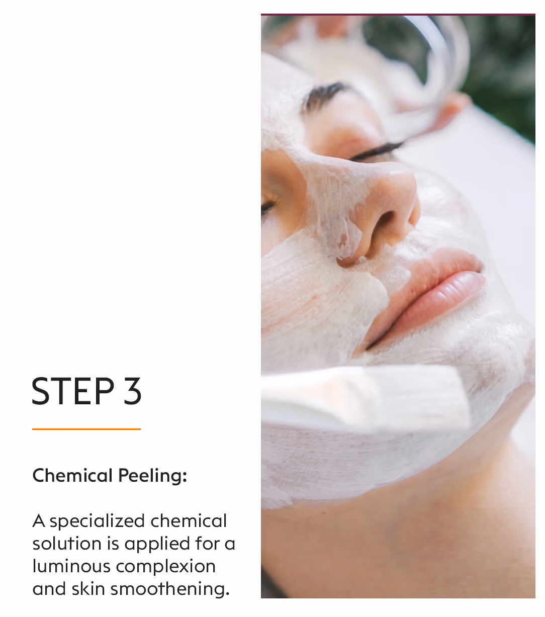 Enzymacid Peel 5
