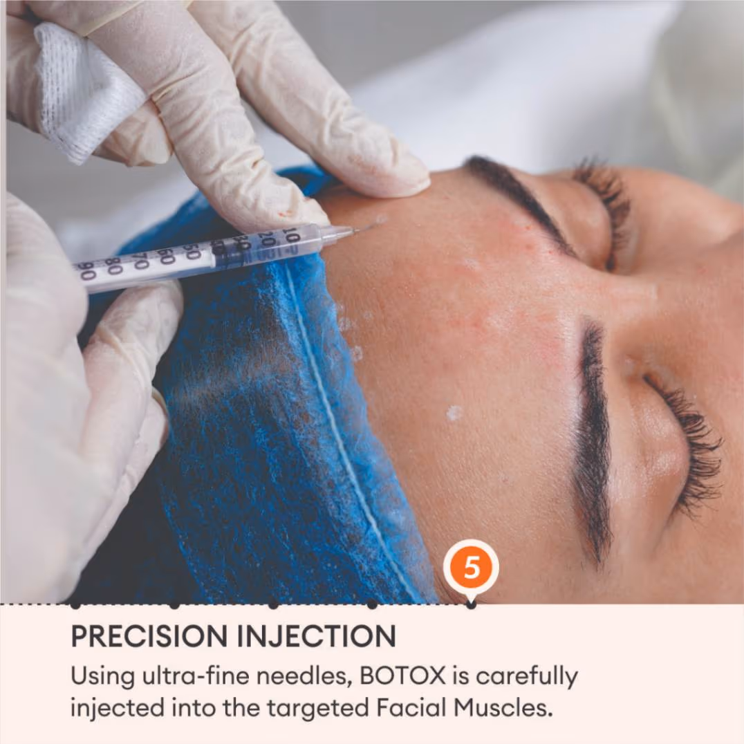 Botox 7