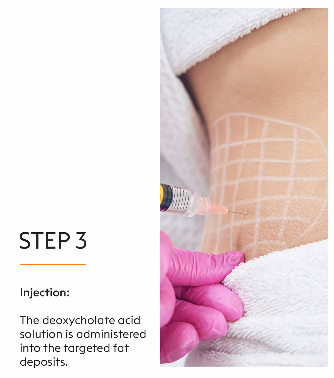 Fat Lipo Injectable 5