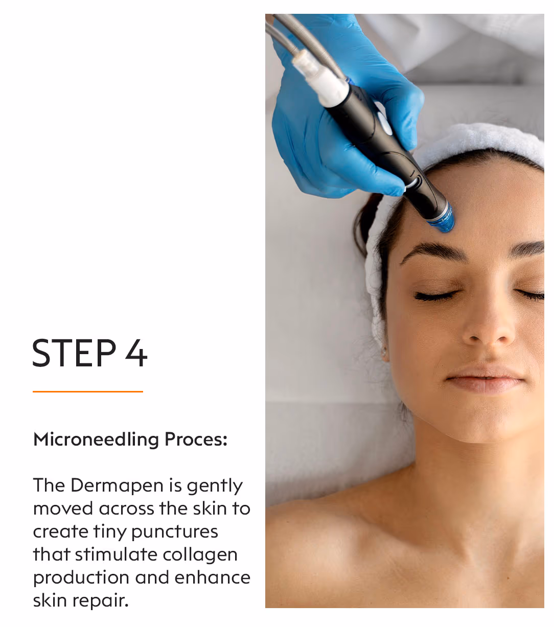 Dermapen Microneedling Treatment 6