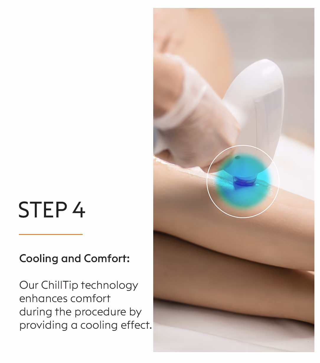 Full Body Laser Hair Removal Treatment 6