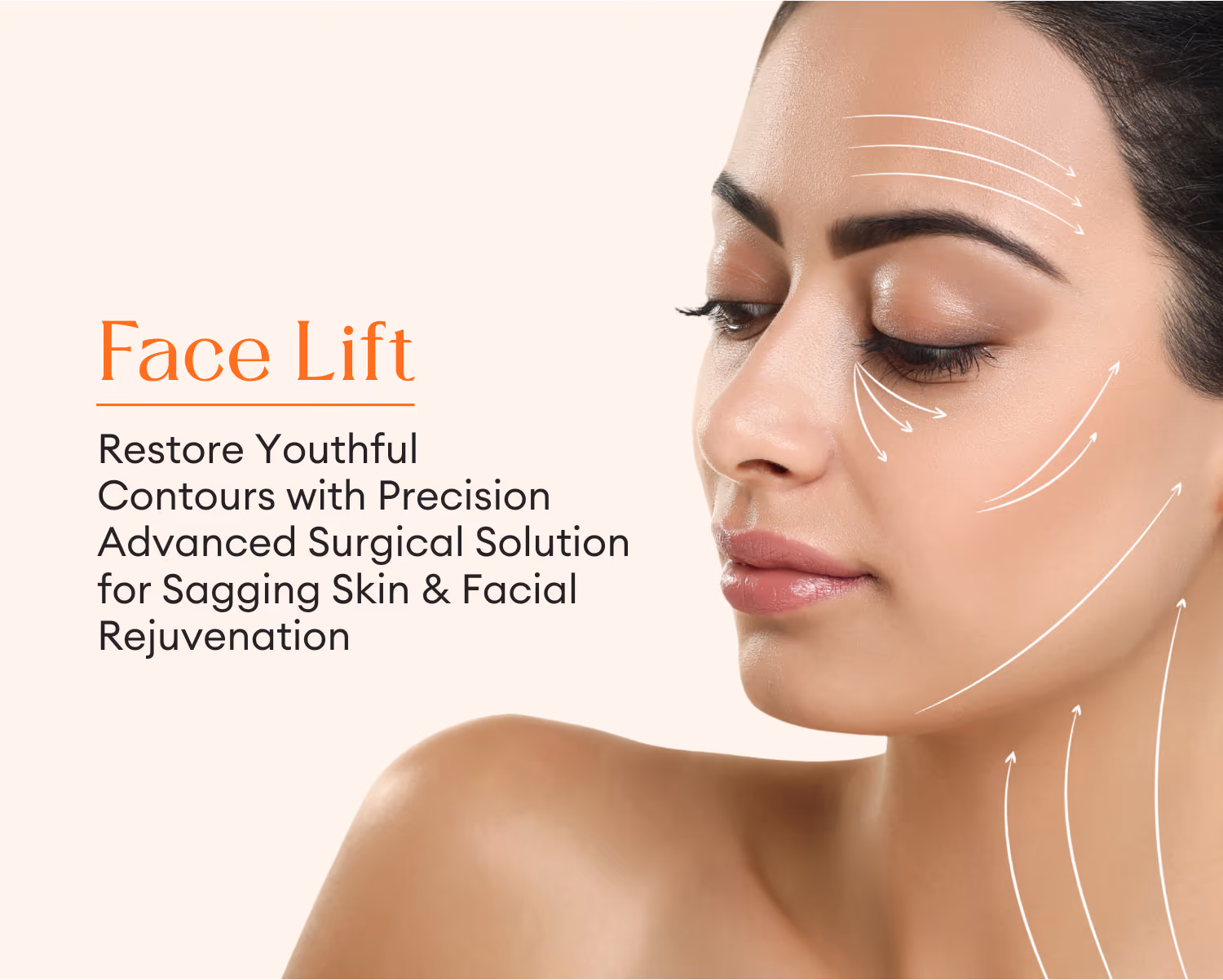 Face Lift Surgery 1