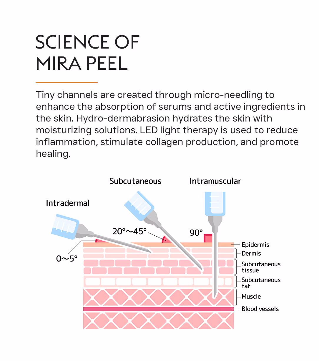 Mira Peel 2