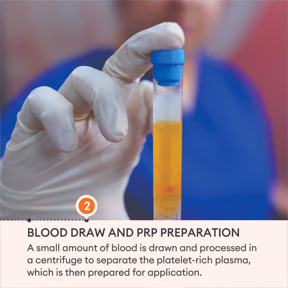 Hair PRP 4