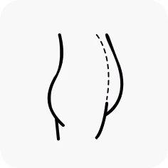 Adequate Pinchable Fat
