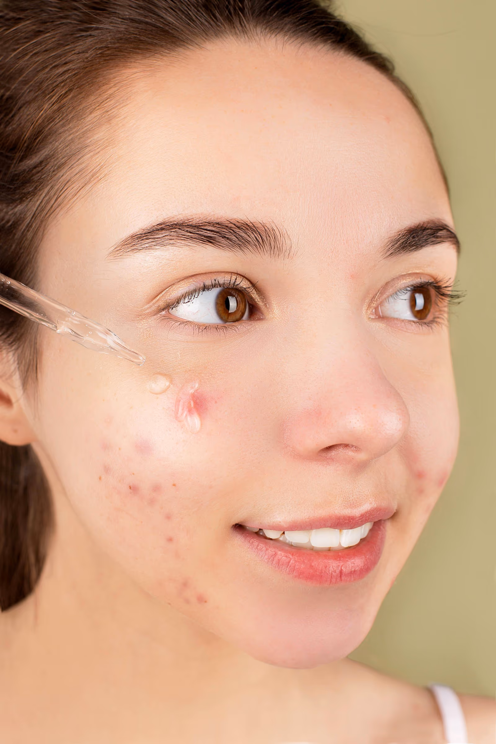 Enzymacid Facial