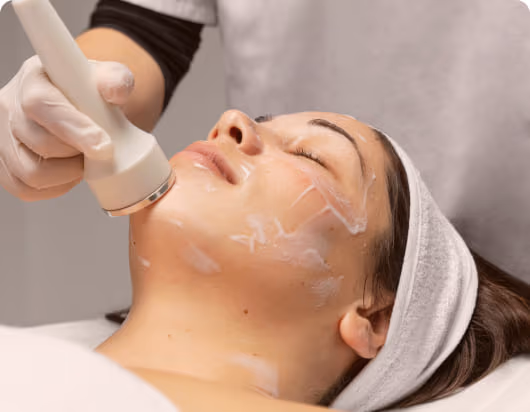 Chemical Peels Acne Scars Treatment