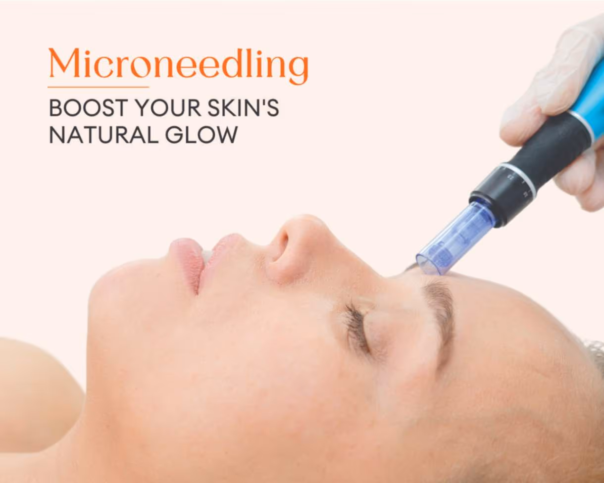 Microneedling