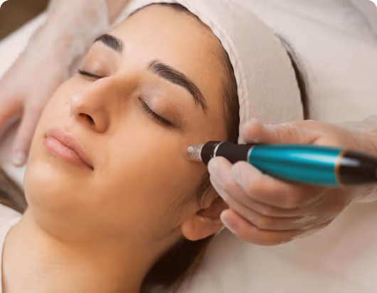 Microneedling and RF