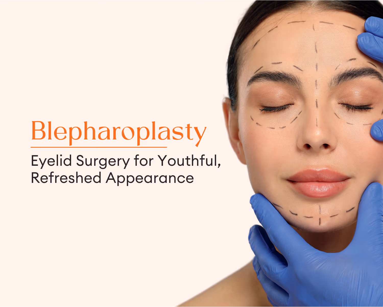 Blepharoplasty