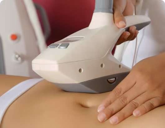 V-Fit Belly Fat Loss Treatment